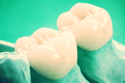 Our crowns are made on site using a cerec machine